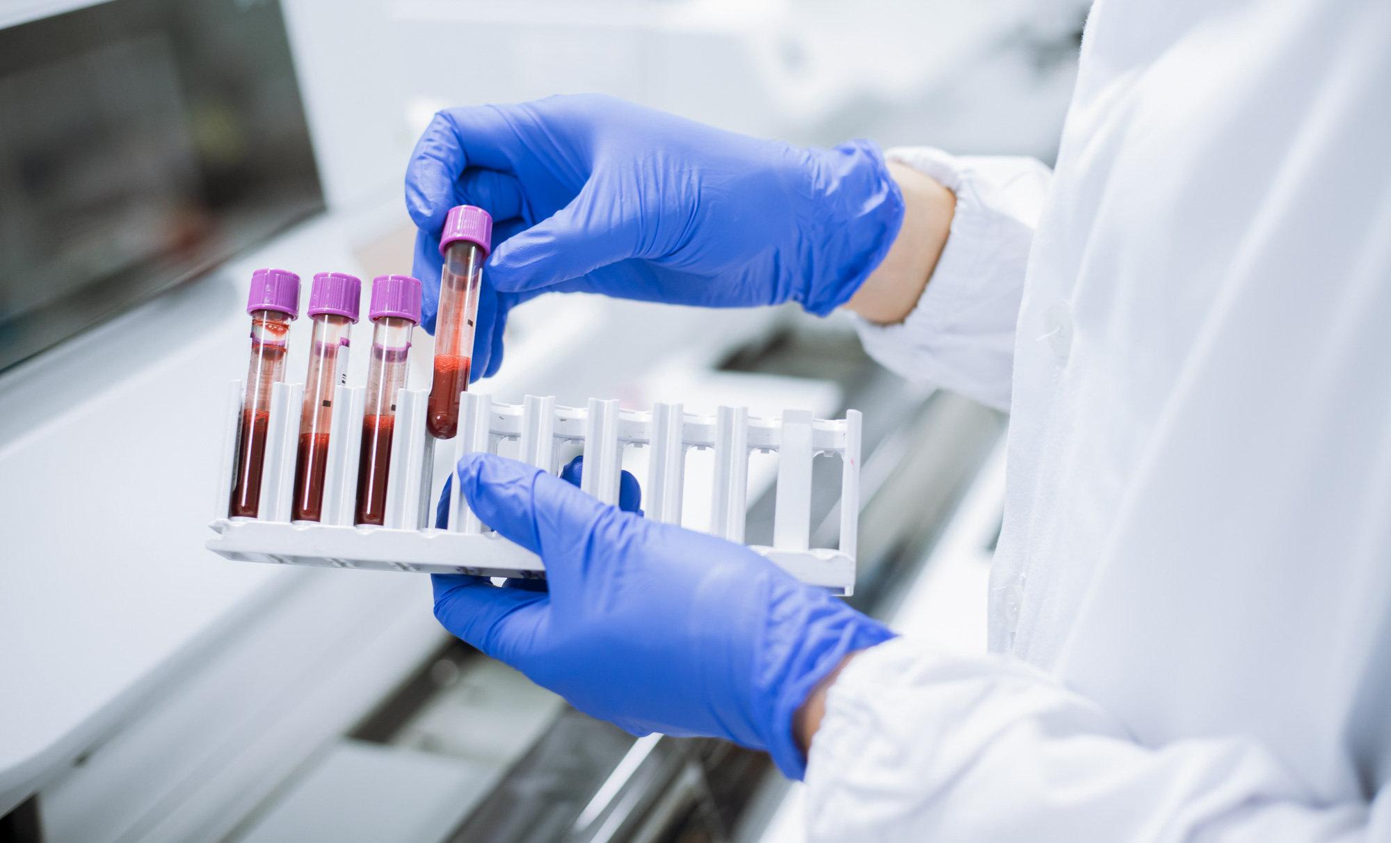 Professor Bruce Robinson appointed as MST’s Senior Biotech & Medical Adviser